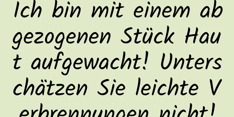 Ich bin mit einem abgezogenen Stück Haut aufgewacht! Unterschätzen Sie leichte Verbrennungen nicht!