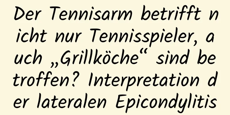 Der Tennisarm betrifft nicht nur Tennisspieler, auch „Grillköche“ sind betroffen? Interpretation der lateralen Epicondylitis