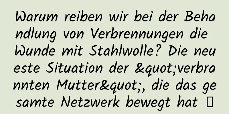 Warum reiben wir bei der Behandlung von Verbrennungen die Wunde mit Stahlwolle? Die neueste Situation der "verbrannten Mutter", die das gesamte Netzwerk bewegt hat →
