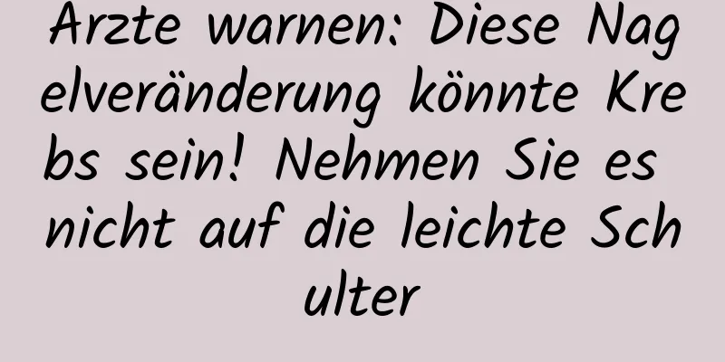 Ärzte warnen: Diese Nagelveränderung könnte Krebs sein! Nehmen Sie es nicht auf die leichte Schulter