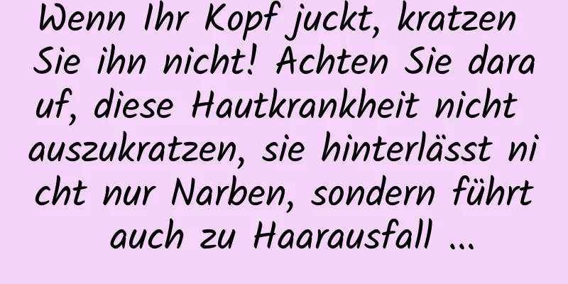 Wenn Ihr Kopf juckt, kratzen Sie ihn nicht! Achten Sie darauf, diese Hautkrankheit nicht auszukratzen, sie hinterlässt nicht nur Narben, sondern führt auch zu Haarausfall ...