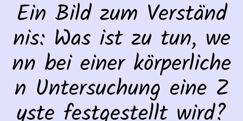 Ein Bild zum Verständnis: Was ist zu tun, wenn bei einer körperlichen Untersuchung eine Zyste festgestellt wird?