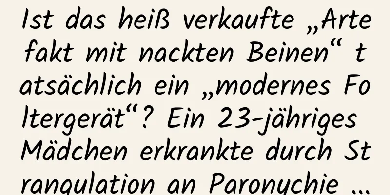 Ist das heiß verkaufte „Artefakt mit nackten Beinen“ tatsächlich ein „modernes Foltergerät“? Ein 23-jähriges Mädchen erkrankte durch Strangulation an Paronychie ...