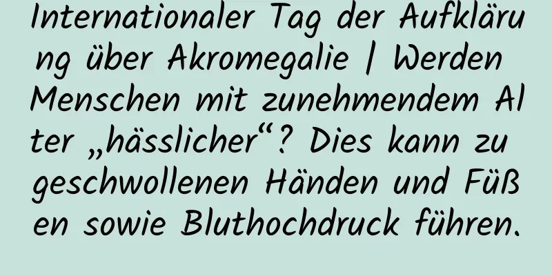 Internationaler Tag der Aufklärung über Akromegalie | Werden Menschen mit zunehmendem Alter „hässlicher“? Dies kann zu geschwollenen Händen und Füßen sowie Bluthochdruck führen.