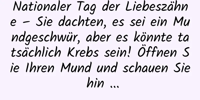 Nationaler Tag der Liebeszähne – Sie dachten, es sei ein Mundgeschwür, aber es könnte tatsächlich Krebs sein! Öffnen Sie Ihren Mund und schauen Sie hin ...