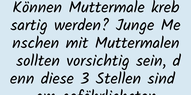 Können Muttermale krebsartig werden? Junge Menschen mit Muttermalen sollten vorsichtig sein, denn diese 3 Stellen sind am gefährlichsten