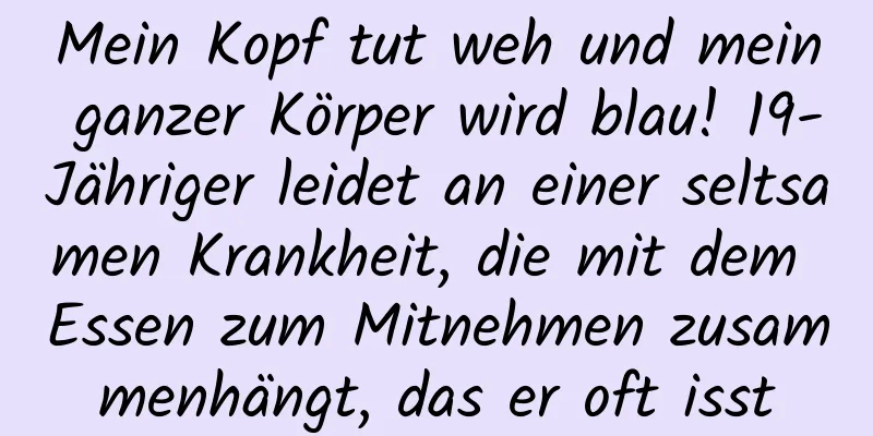 Mein Kopf tut weh und mein ganzer Körper wird blau! 19-Jähriger leidet an einer seltsamen Krankheit, die mit dem Essen zum Mitnehmen zusammenhängt, das er oft isst