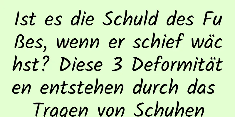 Ist es die Schuld des Fußes, wenn er schief wächst? Diese 3 Deformitäten entstehen durch das Tragen von Schuhen