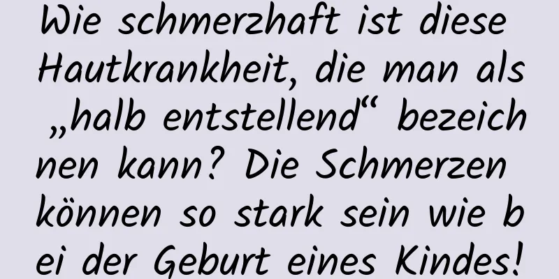 Wie schmerzhaft ist diese Hautkrankheit, die man als „halb entstellend“ bezeichnen kann? Die Schmerzen können so stark sein wie bei der Geburt eines Kindes!