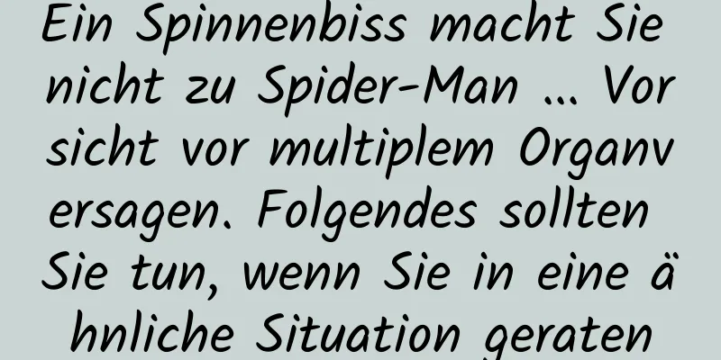 Ein Spinnenbiss macht Sie nicht zu Spider-Man ... Vorsicht vor multiplem Organversagen. Folgendes sollten Sie tun, wenn Sie in eine ähnliche Situation geraten