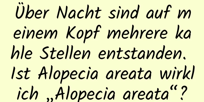 Über Nacht sind auf meinem Kopf mehrere kahle Stellen entstanden. Ist Alopecia areata wirklich „Alopecia areata“?