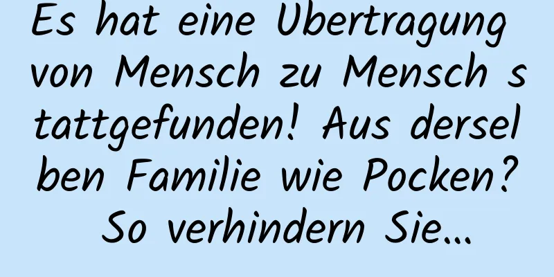 Es hat eine Übertragung von Mensch zu Mensch stattgefunden! Aus derselben Familie wie Pocken? So verhindern Sie…