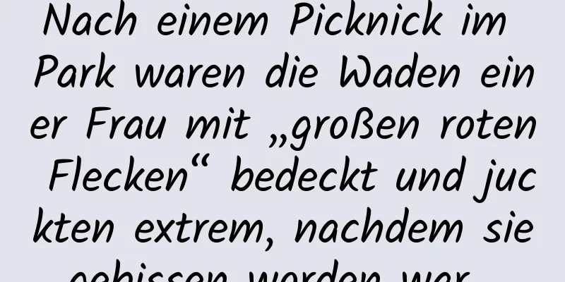 Nach einem Picknick im Park waren die Waden einer Frau mit „großen roten Flecken“ bedeckt und juckten extrem, nachdem sie gebissen worden war …